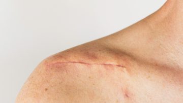 Dofinansowania KFS dla fizjoterapeutów — sprawdź, na jakie kursy możesz otrzymać wsparcie